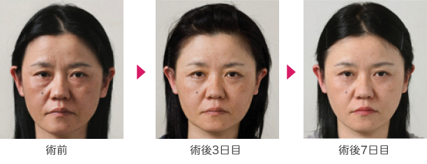 若返り04