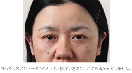 若返り05