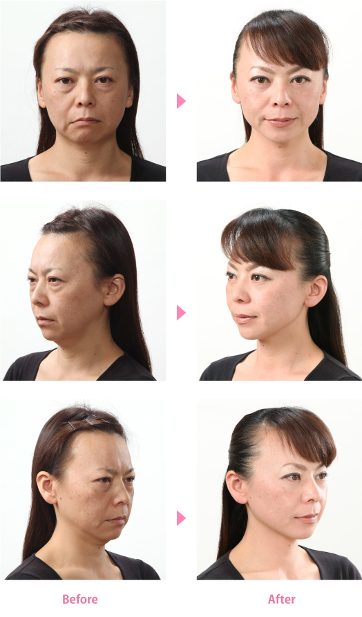 No42_6枚縦写真
