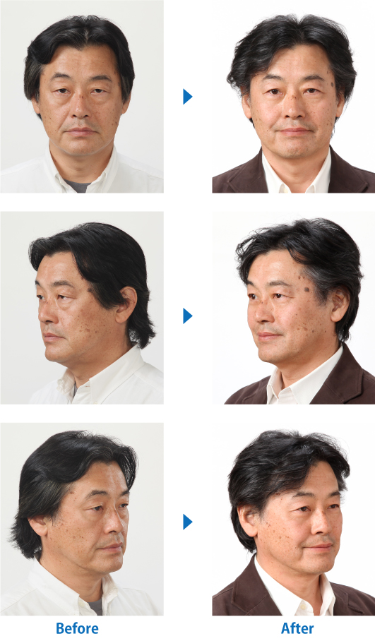 No8_6枚縦写真
