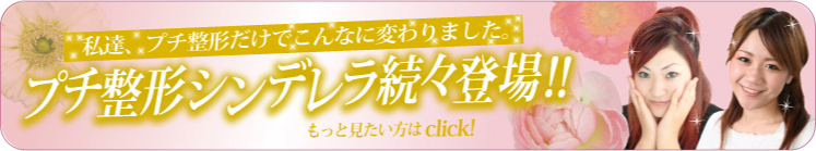 私達、プチ整形だけでこんなに変わりました。